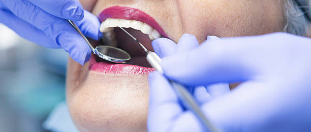 Best Urgent Care for Lost Fillings or Crowns in Montrose, VA